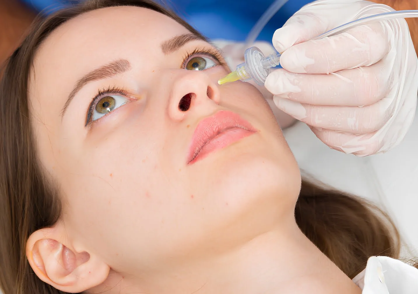 Carboxiterapia facial profesional en Cali