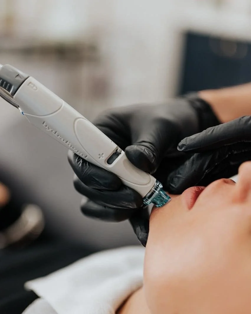 HydraFacial profesional en Cali