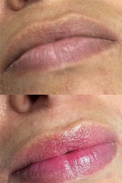 Hidralips hidratación labial en Cali