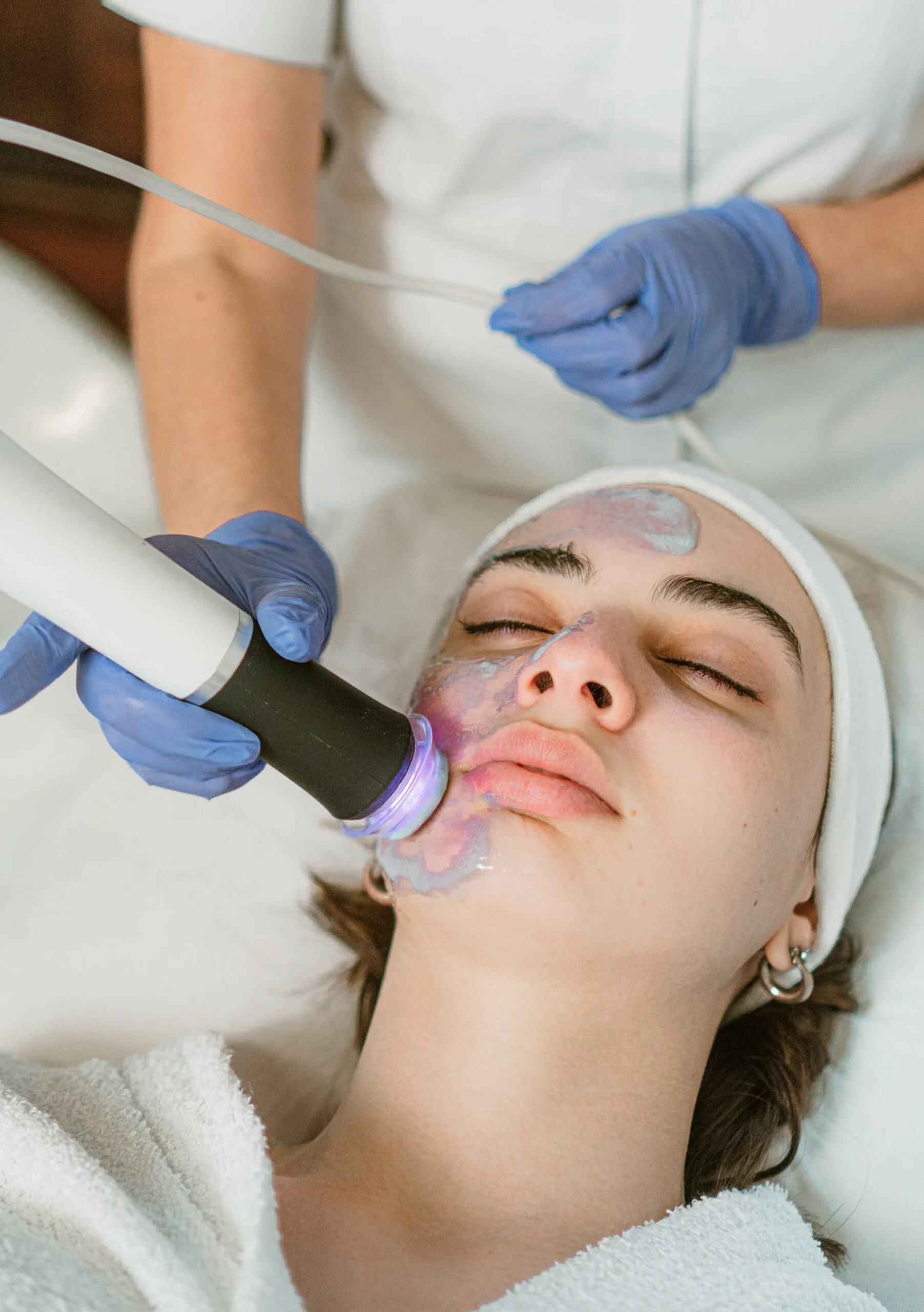 Oxigenoterapia facial profesional en Cali