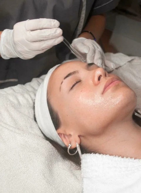 Peeling químico profesional en Cali